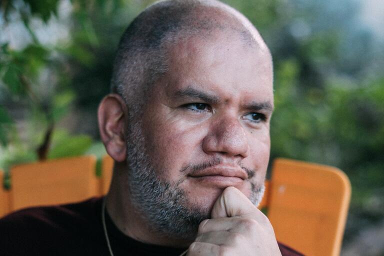 Close-up of a person with a shaved head, resting their chin on their hand, with a thoughtful expression.